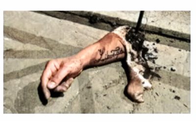 The Severed Arm of Ibiza. Urban Myth or True Story.