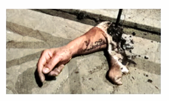 The Severed Arm of Ibiza. Urban Myth or True Story.